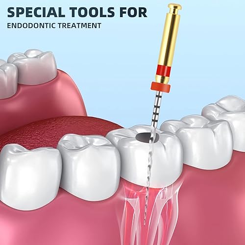6pcs Dental NiTi Super Files – Rotary Tip Endodontic Files, 25mm, FDA Registered