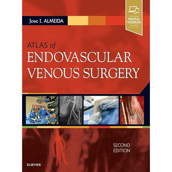 Endovascular Surgery: Expert Consult - Online and Print