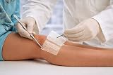 MediSale Non-Adherent Impregnated Wound Contact Layer Dressings 10 Pack 10cm x view 3