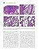 Cutaneous Soft Tissue Tumors