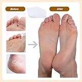 Scettar Moisturizing Foot Socks 4 Pairs Overnight Cotton Spa Socks Dry Feet view 4