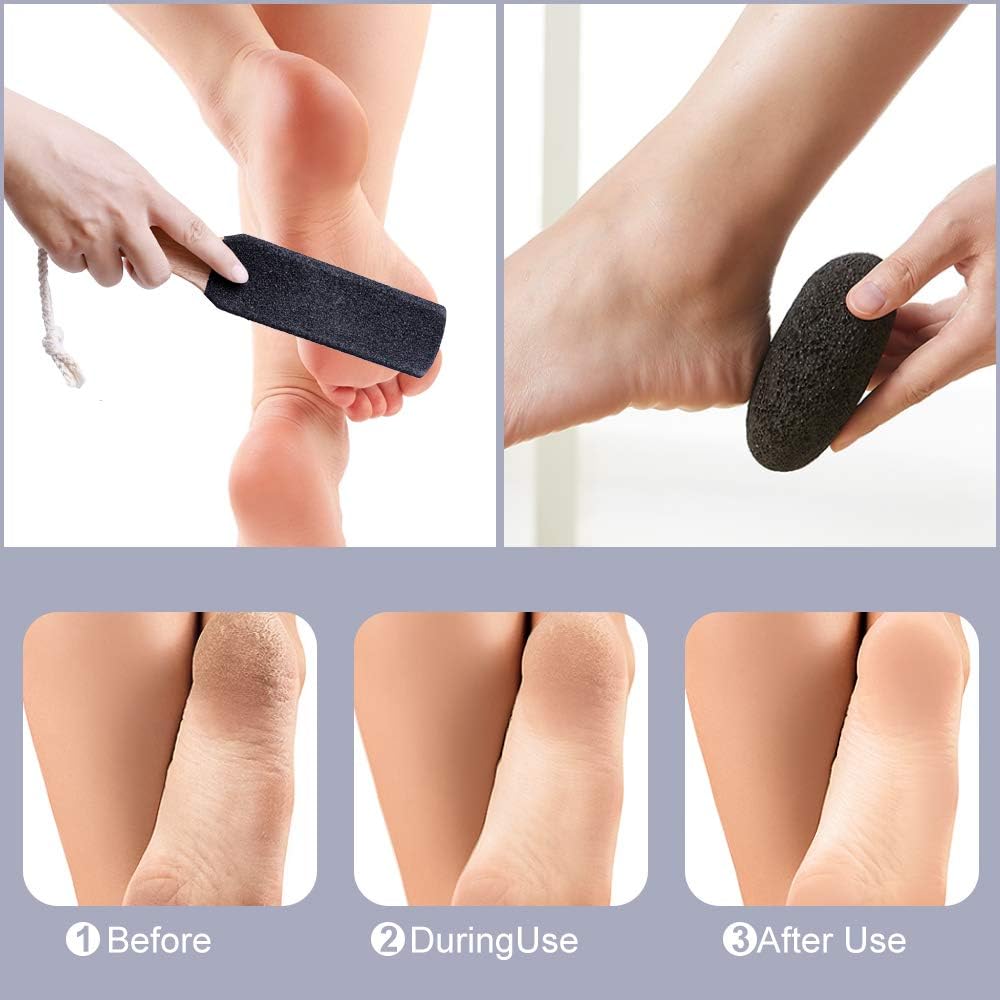 PETSUPS Natural Pumice Stones for Feet Premium Exfoliator & Foot File,Foot File Callus Remover Foot Cracked Heels,Dead Skin,Hard Skin - Image 4