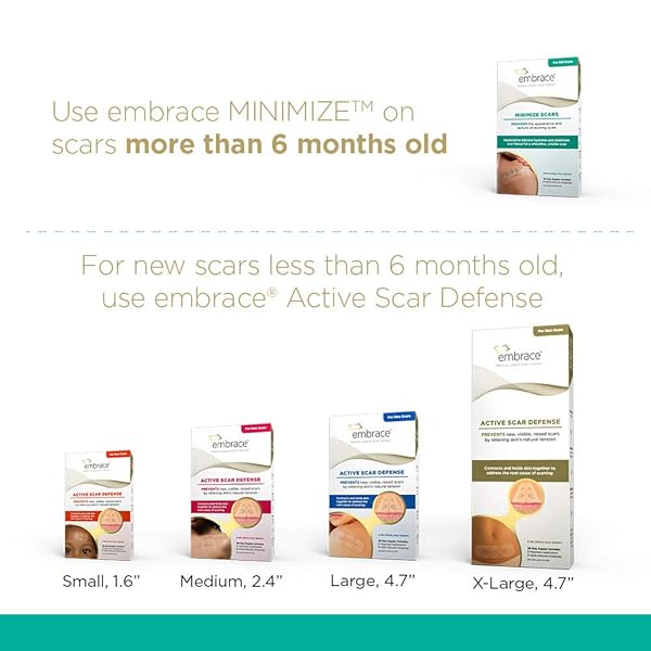 EMBRACE MINIMIZE FOR OLD SCARS, CUT-TO-SIZE LARGE (4.7″) SILICONE SCAR SHEETS, 60 DAY SUPPLY (RECOMMENDED TREATMENT)