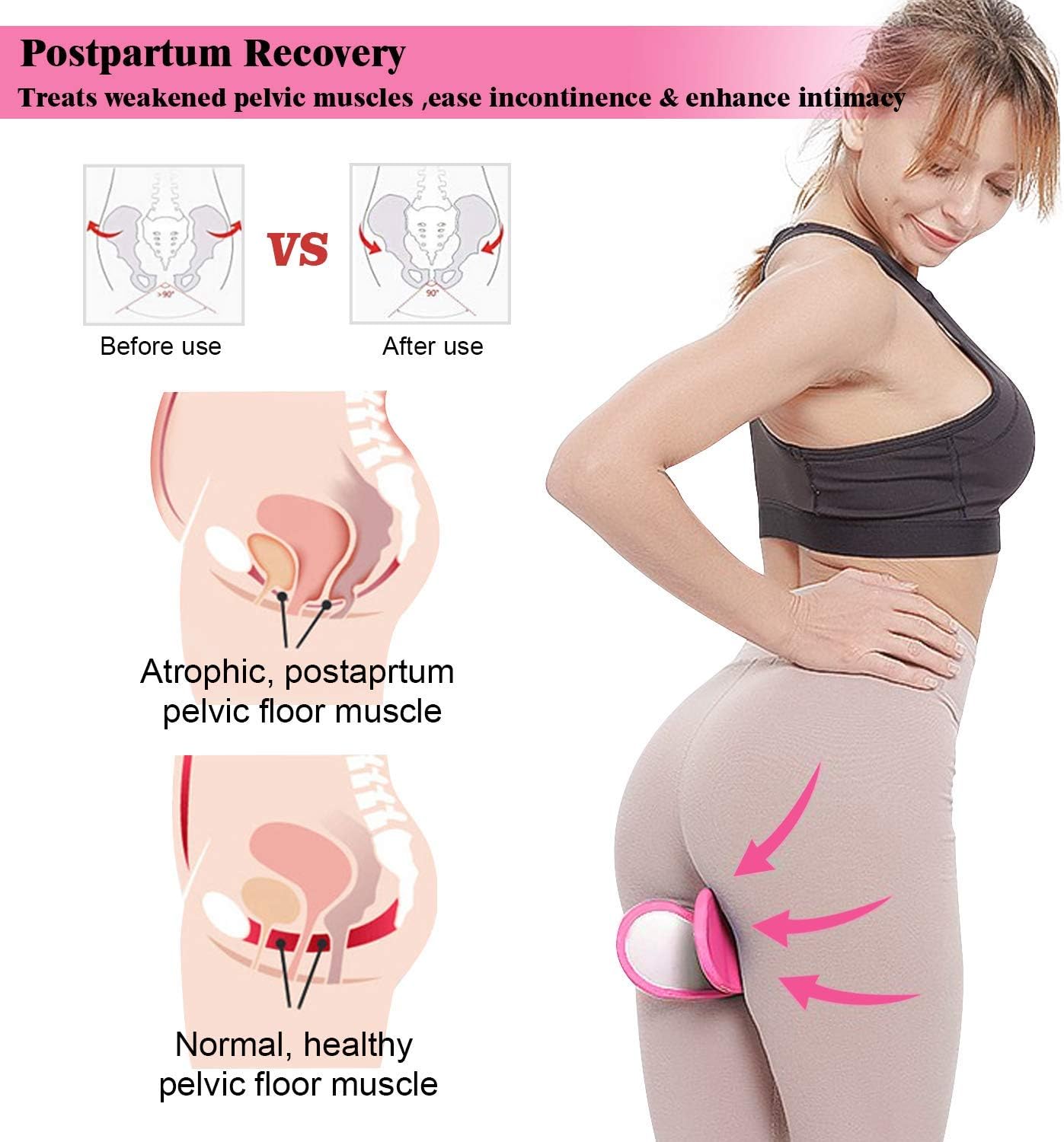Kegel Exerciser Device – Kegels for Women – Improve Bladder Control, Postpartum Muscle Recovery, Reduce Thigh Fat, Tighten Buttocks and Glutes – Easy to Use Kegel Toner – Pelvic Floor Kegel Trainer: Sports & Outdoors