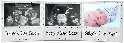 Cadre 3 En 1 Pour Echographie De Grossesse Et Echographie De 12 A Semaines Amazon Fr Bebes Puericulture