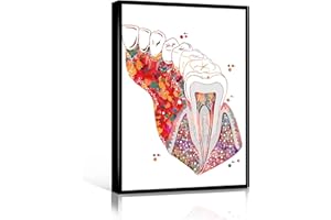 WINDRAIN Medical Wall Art,Molar Tooth Section Dental Art Print Art Teeth and Gums Molar with Enamel Dentin Pulp Root Medical art Watercolor Dentist Clinic Art,8x12 inch framed wall art