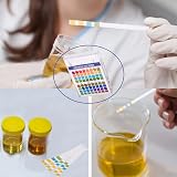 Faumsut 100Pcs pH Test Strips 0-14 for Water & Soil Testing Kit view 6