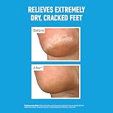 O’Keeffe’s Healthy Feet Overnight 5 x 80ml Tubes Intensive Foot Cream view 3