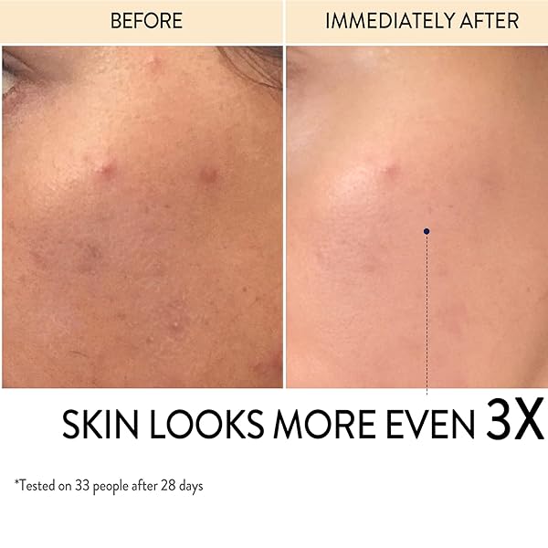 VITAMIN C FACE SERUM HYDRATING: COLORFARM SKIN TIGHTENING WITH VITAMIN E HYALURONIC ACID – ANTI-AGING FOR GLOW SKIN 1 FL OZ