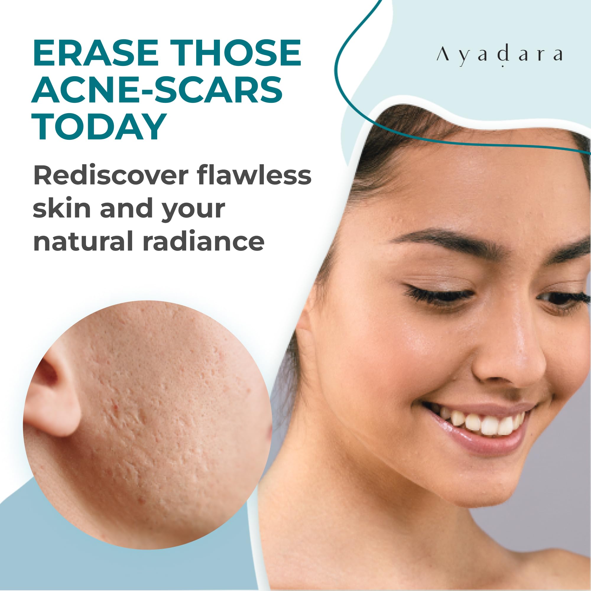 Ayadara Acne Scar Healing Cream, 2 fl oz, Acne Scar Treatment for Face