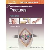 Master Techniques in Orthopaedic Surgery: Fractures