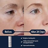 Elemis Dynamic Resurfacing Super-C Serum 30ml Brightening Vitamin C view 2