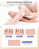 Blissky IPL Hair Removal Device, 9 Energy Levels, 999,900 Flashes view 4
