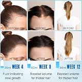 GoldWorld Rosemary Oil for Hair Growth 2x120ml Hair Serum Diluted view 3