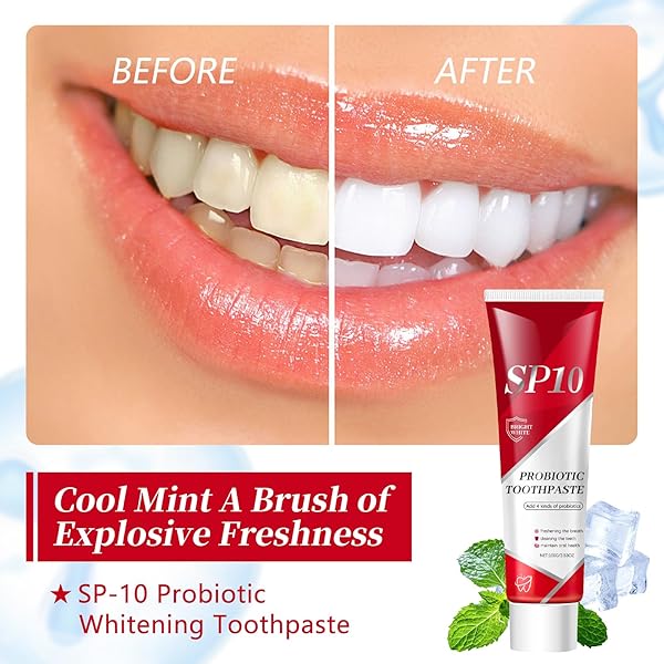 SP-10 PROBIOTIC WHITENING TOOTHPASTE – ULTRA WHITENING & STAIN REMOVAL, DEEP CLEANING, FRESH BREATH FORMULA WITH PROBIOTICS (1)