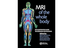 MRI of the Whole Body: An Illustrated Guide for Common Pathologies