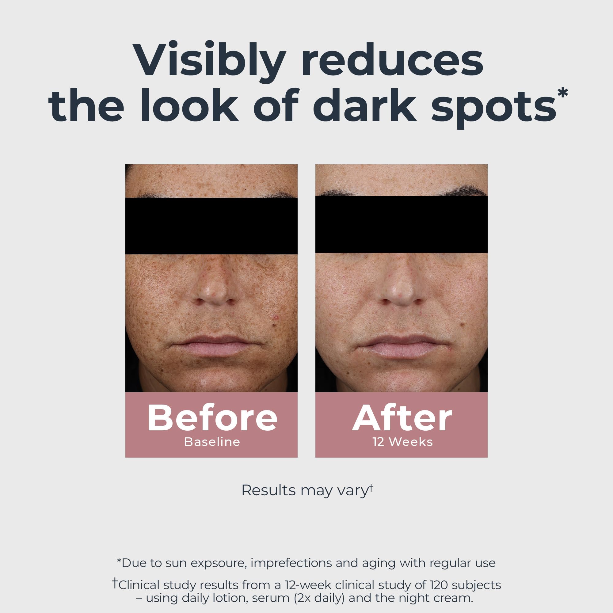 Eucerin Radiant Tone Dual Serum Dark Spot Corrector, Dark Spot Serum with Thiamidol and Hyaluronic Acid, Helps Visibly Reduce the Look of Dark Spots, Holiday Gifts for Self Care, 1 Fl Oz Bottle