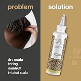 Australian Bodycare Scalp Serum 150ml Dry Itchy Flaky Scalp Dandruff Spots Tea view 2