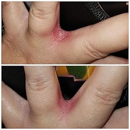 Amazon Com Customer Reviews Emuaid Ointment Antifungal