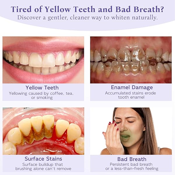 TEETH WHITENING POWDER, REMINERALIZING HYDROXYAPATITE TOOTH POWDER WITH NIACINAMIDE,R5X PURPLE COLOR CORRECTOR FOR INSTANT BRIGHTENING, ENAMEL REPAIR & LONG-LASTING NATURAL WHITE-30G