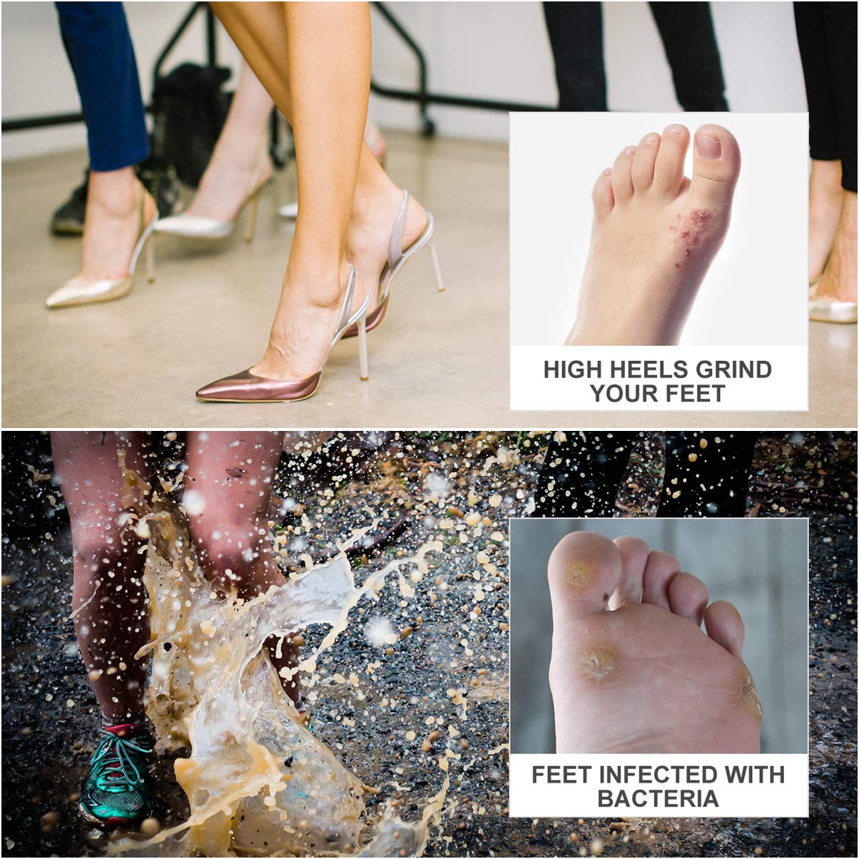 HEALLILY Foam Callus Cushion Self Adhesive Soft Foam Callus Cushions Toe Pads Corn Protector Callus Cushions for Pain Relief Feet Toes 108PCS 12 Sheets : Beauty