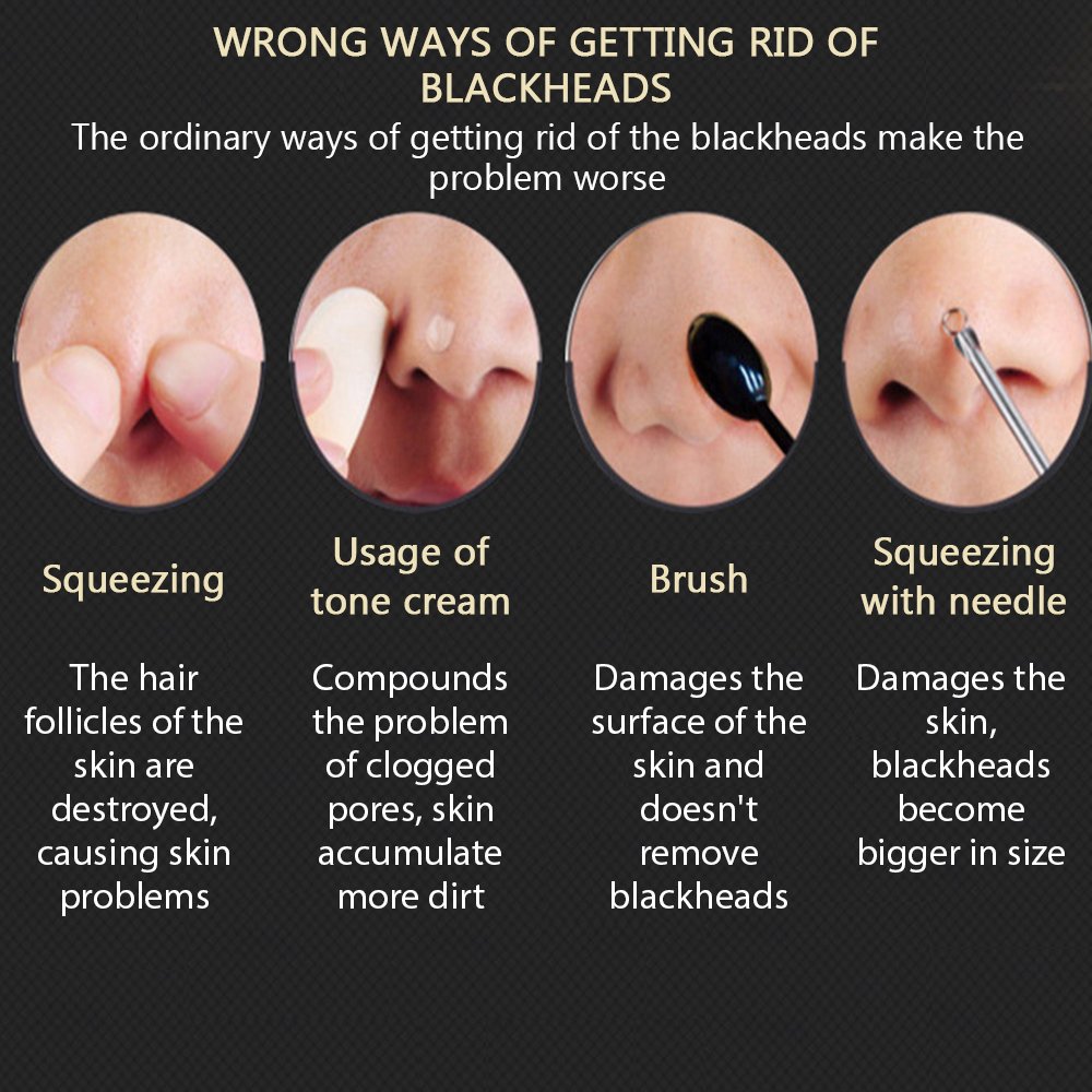get rid of blackheads the ordinary