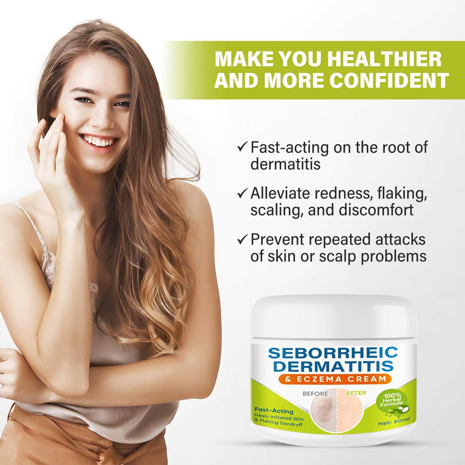 Sêborrheic Dêrmatitis Cream for Fôlliculitis Treatment, Psôriasis Rêlief for Adults, Premium Eczêma Lotion for Dândruff Treatment and Effective Rêlief Îtchy Skin, 2.1 Oz