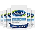 CETAPHIL Gentle Cleansing Bar, 4.5 oz Bar (Pack of 6), Nourishing Cleansing Bar For Dry, Sensitive Skin, Non-Comedogenic, (Packaging May Vary)