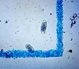 Eggzamin McMaster Method Microscope Slide Fecal Egg Count for Parasites view 2