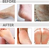 GNAUMORE Foot Spa Gift Set Jelly Pedicure Pack Rose Foot Soak Salts for Dry Skin view 5