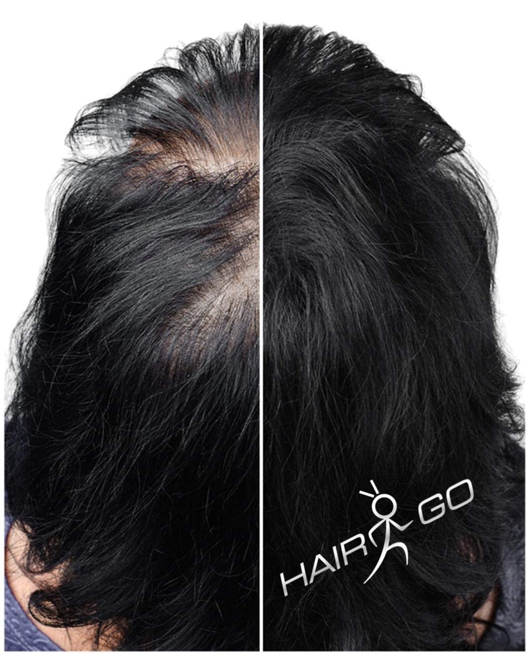 HAIR GO Premium Schütthaar zur Haarverdichtung | Haarpuder | Streuhaar | Haarauffüller | Haarausfall | Haarverdichter 100% natürlich & vegan, 1er Pack, (1x 25 gr.) (schwarz) 2