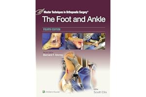Master Techniques in Orthopaedic Surgery: The Foot and Ankle: eBook without Multimedia (Master Techniques in Orthopaedic Surg