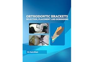 Orthodontic Brackets: Selection,Placement and Debonding