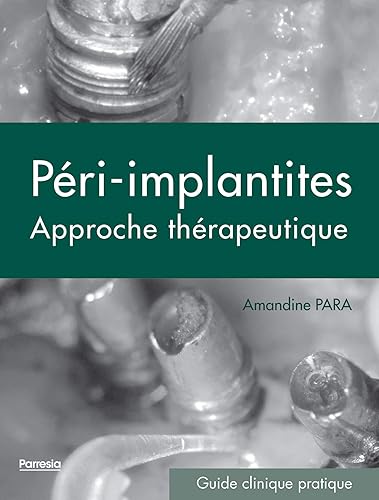 Download Péri-implantites : Approche thérapeutique PDF