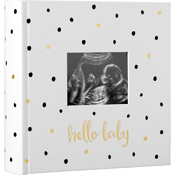 Amazon.com : Pearhead Baby Photo Album, Keepsake Book for