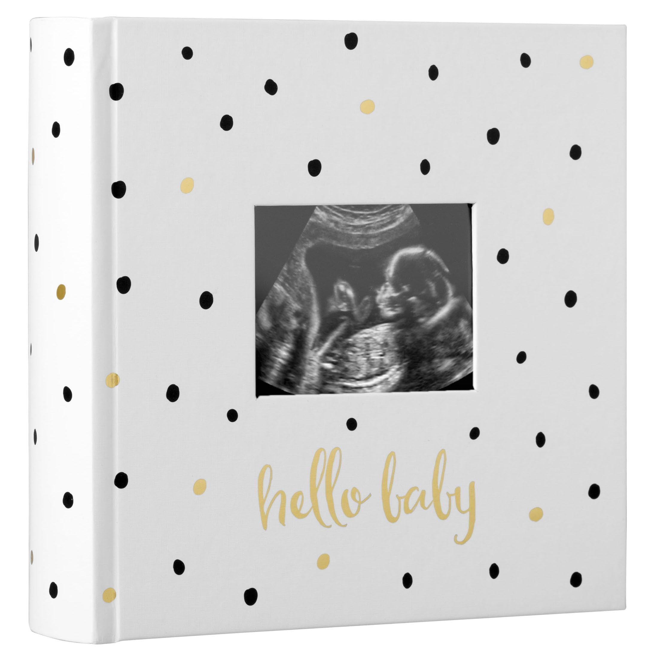 Pearhead Baby Photo Album, Baby Book Keepsake for New and Expecting Parents, Gender-Neutral Baby Accessory, Black and Gold Polka Dot — image 1