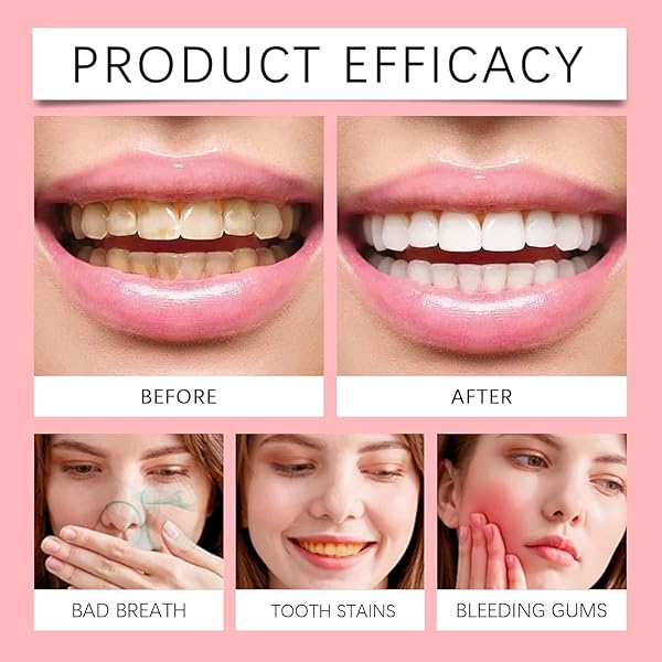 SP 10 PROBIOTIC TOOTHPASTE WHITENING – IMPROVE ORAL HEALTH WITH DENTAL PROBIOTIC FOR A BRIGHTER TOOTH (1)