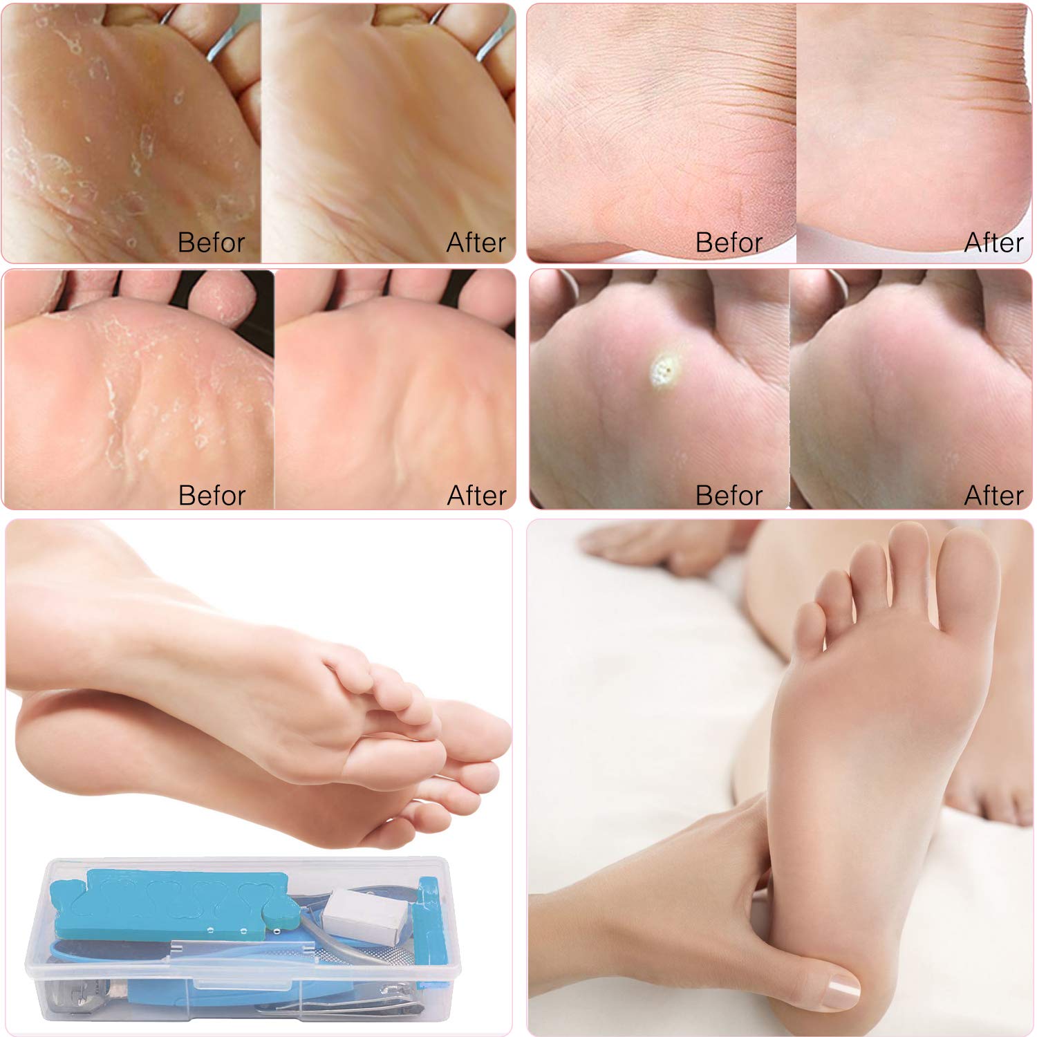 Professional Pedicure Tools Kit 20 in 1, Foot Care Kit Stainless Steel Foot Rasp Foot Peel and Callus Clean Foot Dead Skin Tool Set, Nail Toenail Clipper Foot Care Kit for Women Men Salon or Home : Beauty