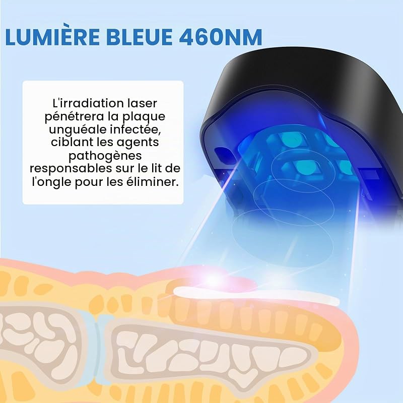Dispositif de Laser pour Mycose Des Ongles, Berrlly Dispositif des Champignons des Ongles Portable Lumière Bleue 460nm Très Efficace, Facile à Utiliser à Maison pour Améliorer Ongles Endommagés (Noir) — photo 2 sur 8