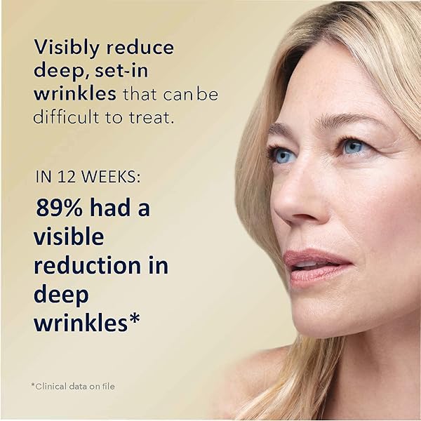ROC RETINOL CORREXION DEEP WRINKLE RETINOL FACE SERUM WITH ASCORBIC ACID, ANTI-AGING TREATMENT FOR FINE LINES, DARK SPOTS, POST ACNE SCARS, 1 OZ (PACKAGING MAY VARY)