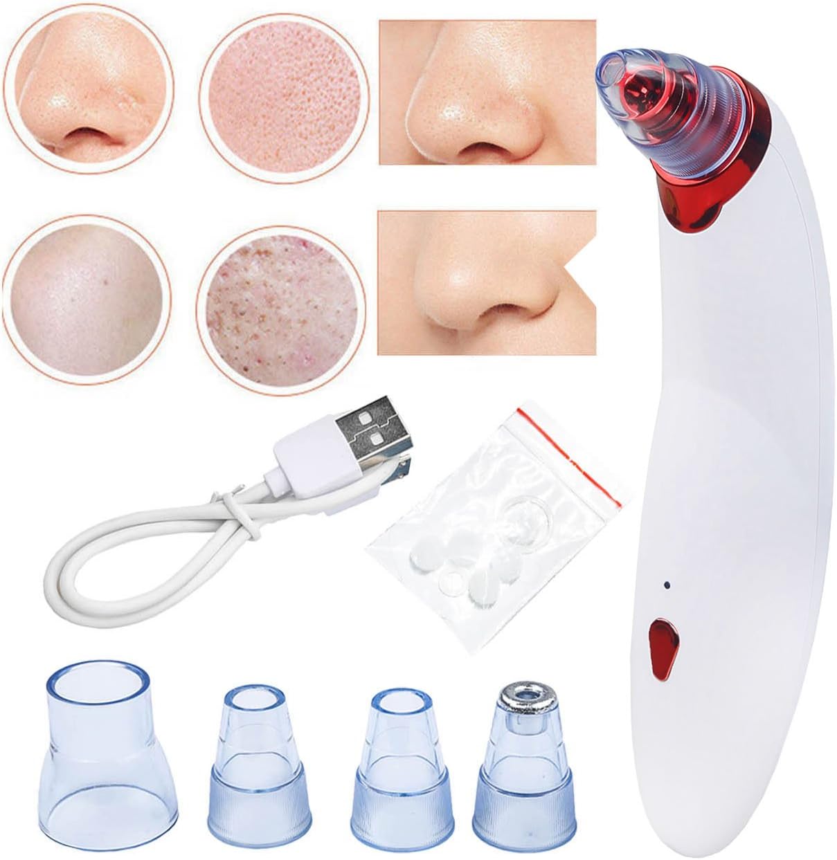 Keep Better Blackhead Vacuum Suction Remover USB Rechargeable Electric Skin Cleanser Blackhead Extractor Tool Skin Pore Cleaner with 5 Replaceable Suction Heads