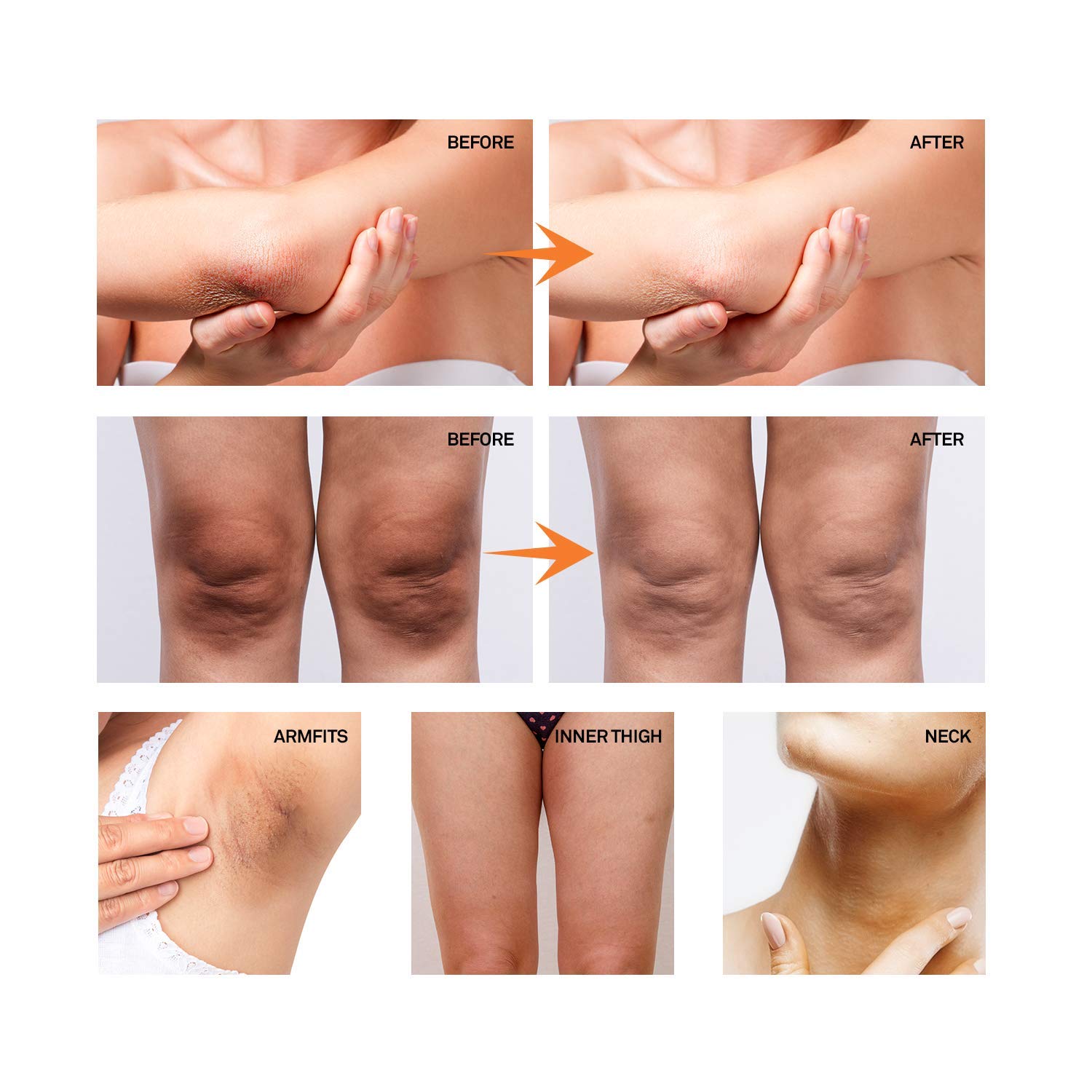 asavea whitening cream side effects