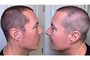 SRUMIE Thicken It 100% Scalp Coverage Hair Powder - DARK BROWN - Talc-Free .32 oz. Water Resistant Hair Loss Concealer. Naturally Thicker Than Hair Fibers & Spray Concealers