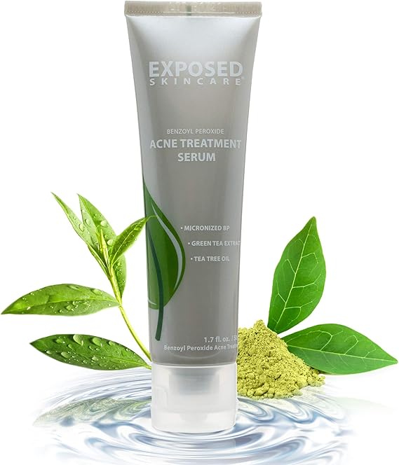 exposed basic acne kit