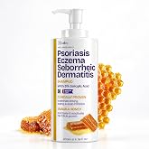 Psoriasis Shampoo for Eczema, and Folliculitis Treatment - Seborrheic Dermatitis Antifungal Shampoo for Ringworm, Acne, Flaking, Dry &amp; Itchy Scalp Treatment - Psoriasis Relief with Manuka Honey