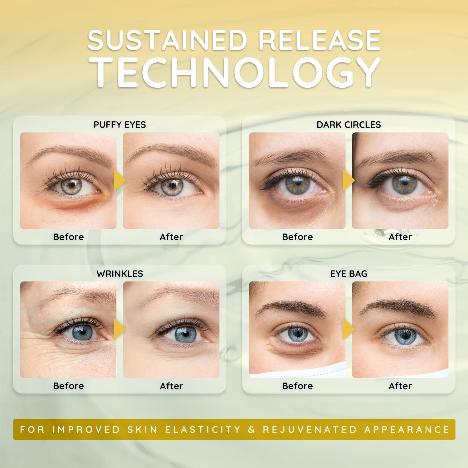 Enaskin Naturals Under Eye Patches for Dark Circles: Premium Gels Pads - Reduce Eye Bags, Wrinkles & Puffy 10 Pairs (Black)