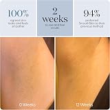 SmoothSkin Pure Adapt IPL Hair Removal Device, Slate Grey, Body & Face view 6