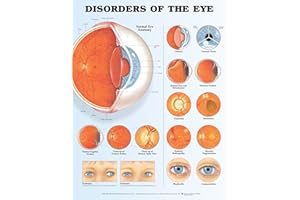 ANATOMY STUFF Disorders of The Eye Anatomical Chart