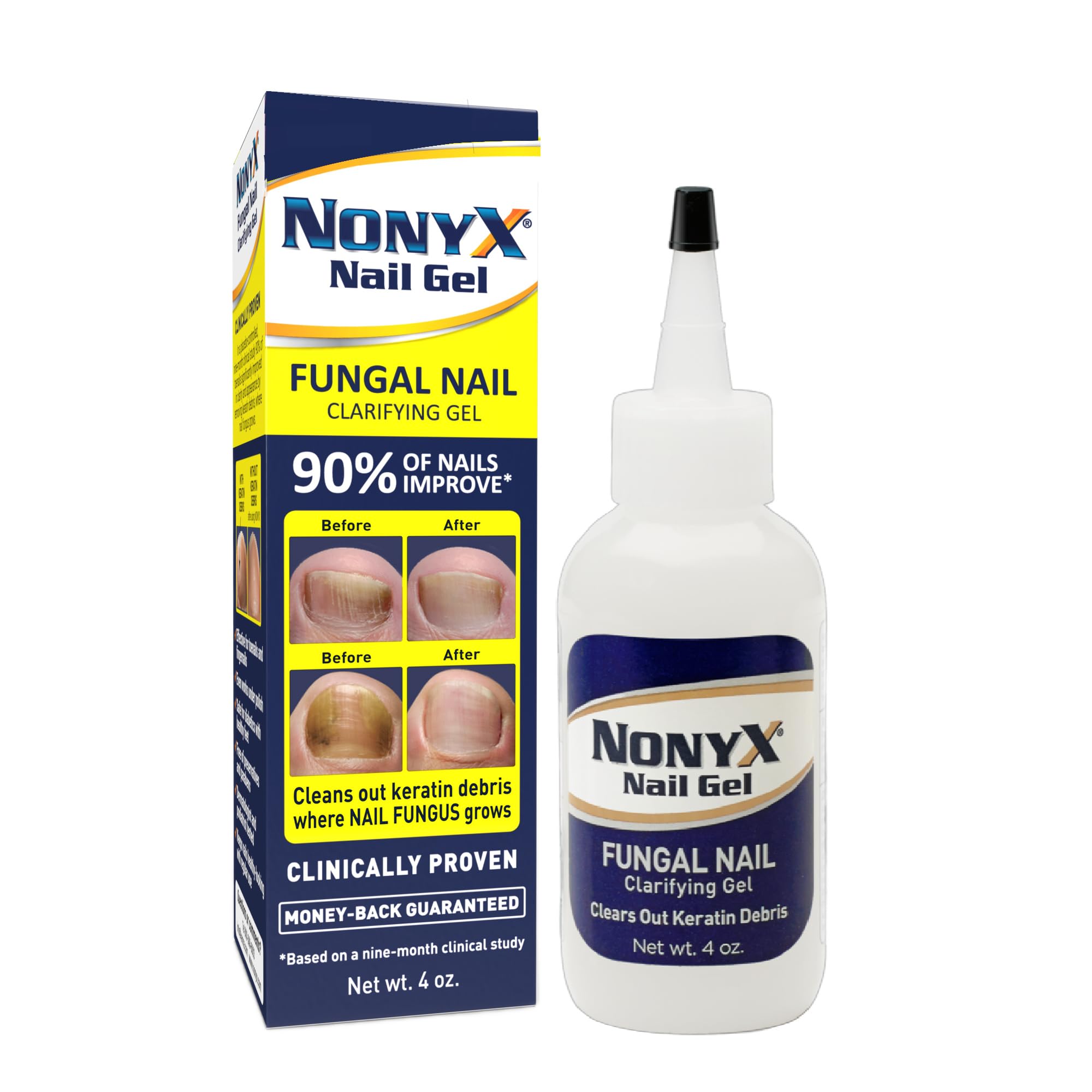 Xenna All Natural NonyX Nail Gel, For Toenails and Fingernails - 4 oz