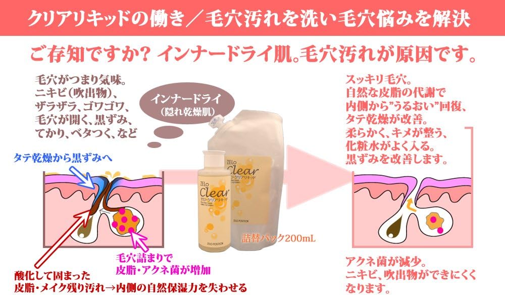 Amazon 毛穴洗顔料 ゼロ Zelo クリアリキッド 150ml Zelo 液体 クリーム洗顔料 通販 Amazon 毛穴洗顔料 ゼロ Zelo クリアリキッド 150ml Zelo 液体 クリーム洗顔料 通販